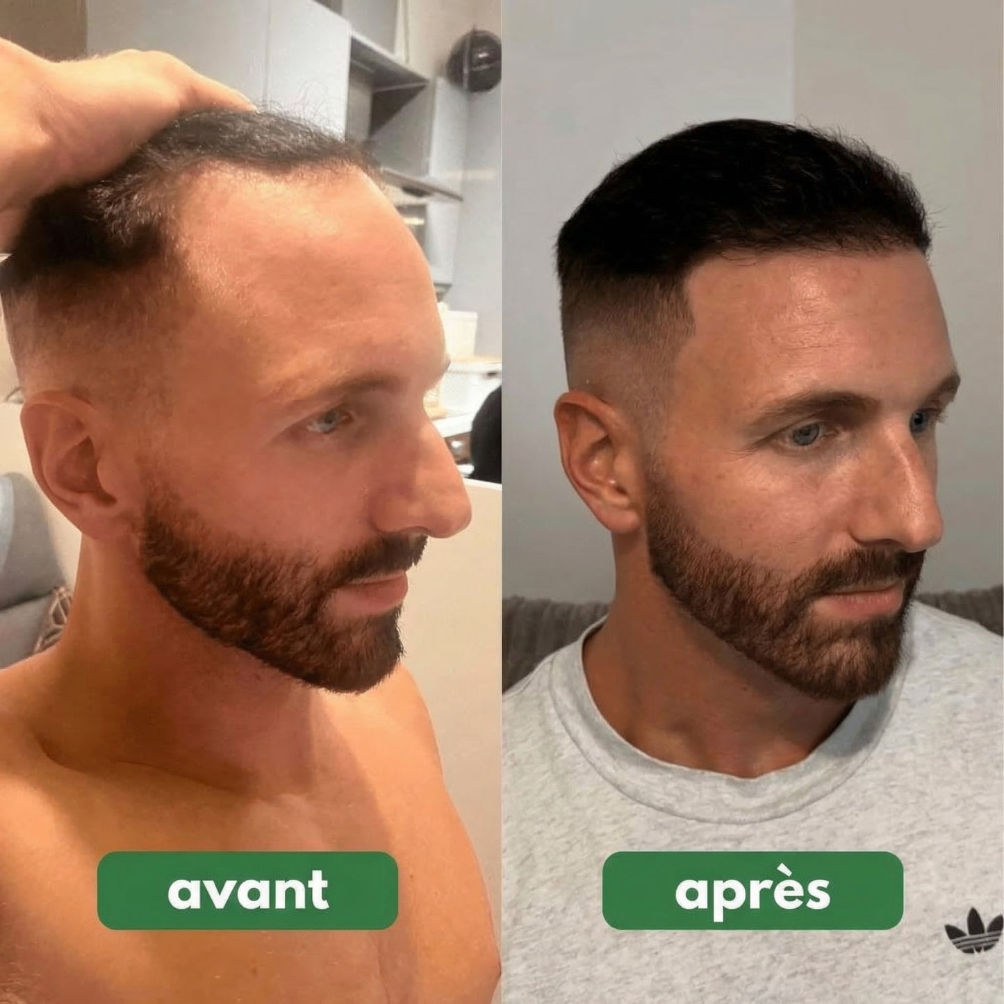 Revitalys™ Huile de Croissance Capillaire