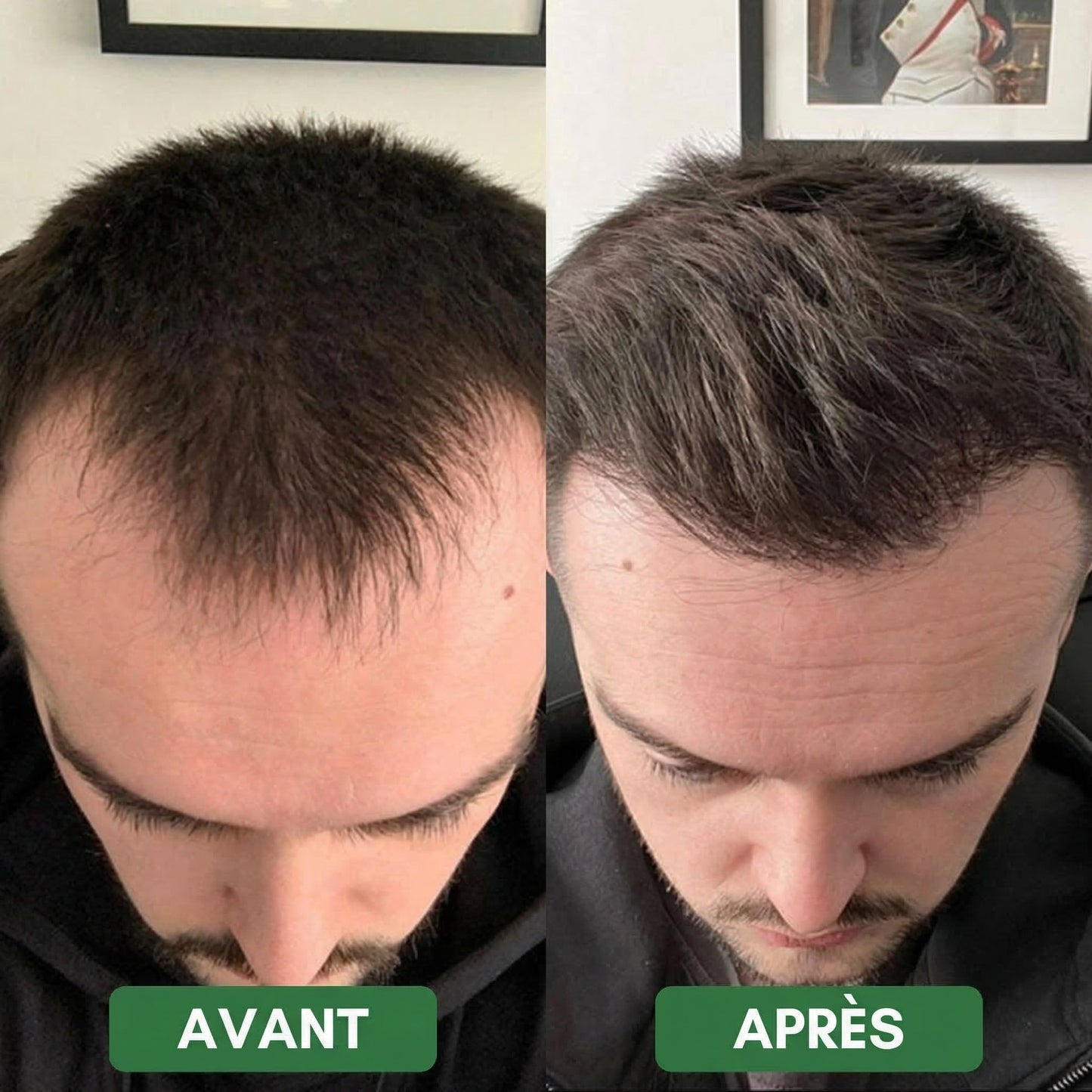 Revitalys™ Huile de Croissance Capillaire