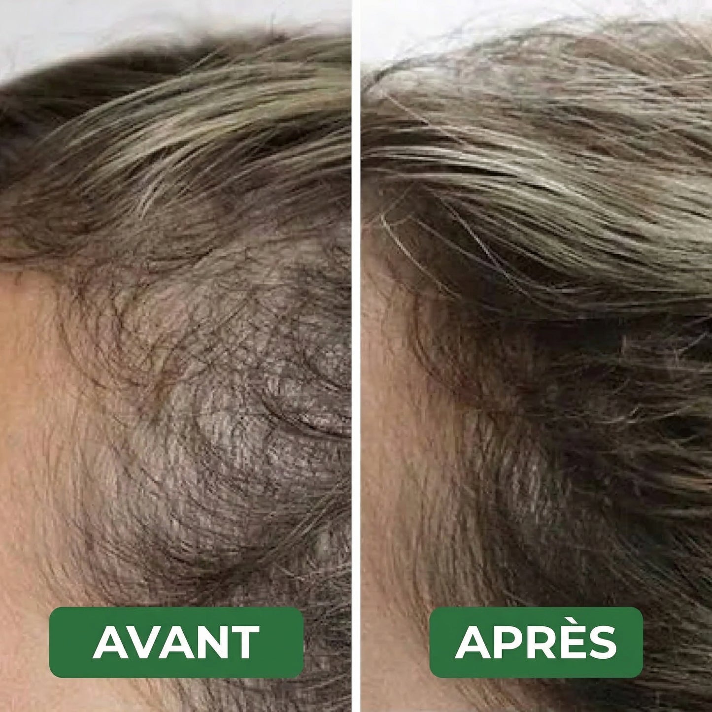 Revitalys™ Huile de Croissance Capillaire