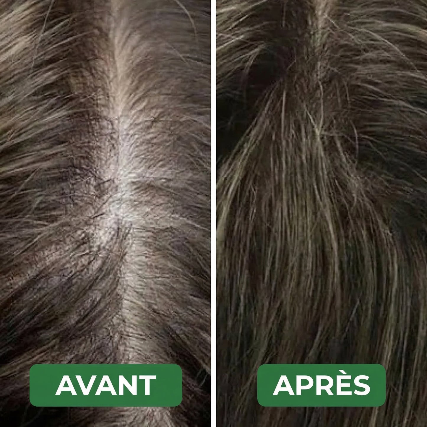 Revitalys™ Huile de Croissance Capillaire